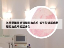 关节型银屑病初期能治愈吗 关节型银屑病初期能治愈吗能活多久