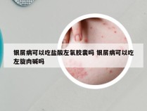 银屑病可以吃盐酸左氧胶囊吗 银屑病可以吃左旋肉碱吗