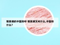 银屑病的中医称呼 银屑病又叫什么,中医称什么?