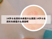 14岁小女孩长头癣是什么原因 14岁小女孩长头癣是什么原因呢