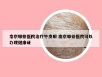 南京哪些医院治疗牛皮癣 南京哪些医院可以办理健康证