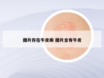 图片存在牛皮癣 图片含有牛皮