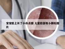 宝宝脸上长了小白点图 儿童脸部有小颗粒图片