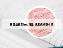 银屑病模型imq用量 银屑病模型小鼠