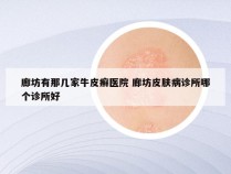 廊坊有那几家牛皮癣医院 廊坊皮肤病诊所哪个诊所好