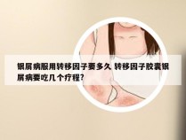 银屑病服用转移因子要多久 转移因子胶囊银屑病要吃几个疗程?