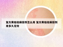 复方黄柏祛癣搽剂怎么用 复方黄柏祛癣搽剂用多久见效