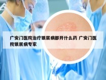 广安门医院治疗银屑病都开什么药 广安门医院银屑病专家