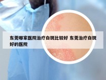 东莞哪家医院治疗白斑比较好 东莞治疗白斑好的医院