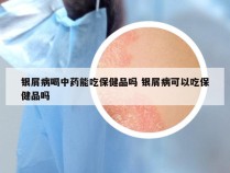 银屑病喝中药能吃保健品吗 银屑病可以吃保健品吗