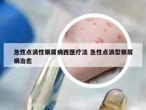 急性点滴性银屑病西医疗法 急性点滴型银屑病治愈