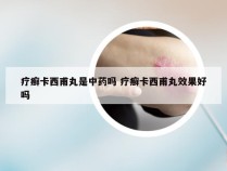 疗癣卡西甫丸是中药吗 疗癣卡西甫丸效果好吗