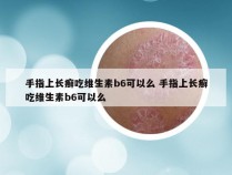 手指上长癣吃维生素b6可以么 手指上长癣吃维生素b6可以么