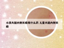 小孩大腿内侧长癣用什么药 儿童大腿内侧长癣