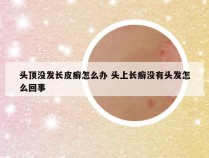 头顶没发长皮癣怎么办 头上长癣没有头发怎么回事