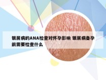 银屑病的ANA检查对怀孕影响 银屑病备孕前需要检查什么