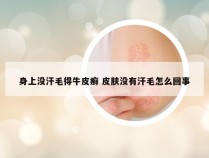 身上没汗毛得牛皮癣 皮肤没有汗毛怎么回事