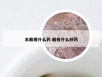 太癣用什么药 癣有什么好药