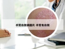 手臂白斑病图片 手臂有白斑