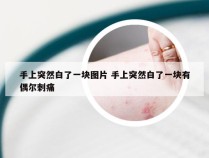 手上突然白了一块图片 手上突然白了一块有偶尔刺痛