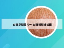 白斑早期图片一 白斑初期症状图