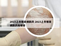 2023上市银屑病新药 2023上市银屑病新药有哪些