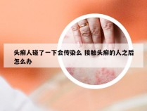 头癣人碰了一下会传染么 接触头癣的人之后怎么办