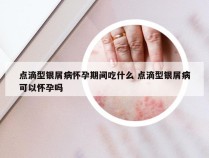 点滴型银屑病怀孕期间吃什么 点滴型银屑病可以怀孕吗