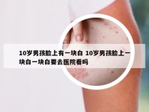 10岁男孩脸上有一块白 10岁男孩脸上一块白一块白要去医院看吗