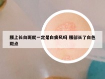 腰上长白斑就一定是白癜风吗 腰部长了白色斑点