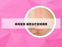 癣用韭菜 韭菜治疗皮肤瘙痒