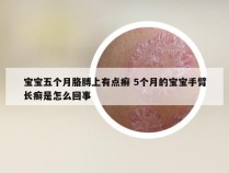 宝宝五个月胳膊上有点癣 5个月的宝宝手臂长癣是怎么回事