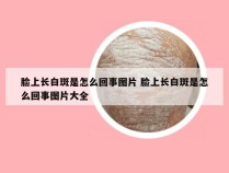 脸上长白斑是怎么回事图片 脸上长白斑是怎么回事图片大全