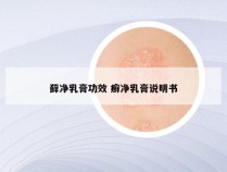 藓净乳膏功效 癣净乳膏说明书