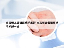 南昌哪儿做银屑病手术好 南昌哪儿做银屑病手术好一点