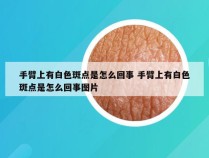 手臂上有白色斑点是怎么回事 手臂上有白色斑点是怎么回事图片