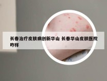 长春治疗皮肤病创新华山 长春华山皮肤医院咋样