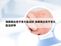 体癣用达克宁多久能治好 体癣用达克宁多久能治好啊