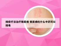 排瘀疗法治疗银屑病 银屑病吃什么中药可以排毒