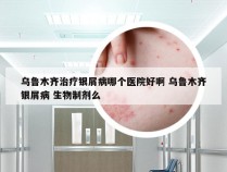 乌鲁木齐治疗银屑病哪个医院好啊 乌鲁木齐银屑病 生物制剂么