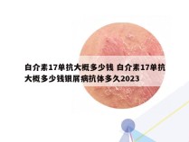 白介素17单抗大概多少钱 白介素17单抗大概多少钱银屑病抗体多久2023