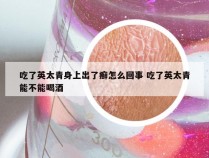 吃了英太青身上出了癣怎么回事 吃了英太青能不能喝酒