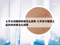 七岁女孩胳膊有癣怎么回事 七岁孩子胳膊上起的肉疙瘩怎么回事