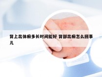 背上出体癣多长时间能好 背部出癣怎么回事儿