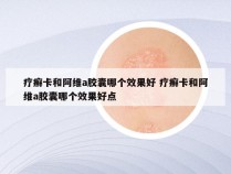 疗癣卡和阿维a胶囊哪个效果好 疗癣卡和阿维a胶囊哪个效果好点