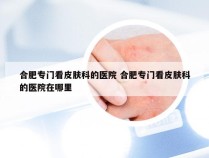 合肥专门看皮肤科的医院 合肥专门看皮肤科的医院在哪里