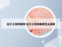 肚子上有块癣疼 肚子上有块癣疼怎么回事