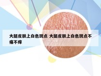 大腿皮肤上白色斑点 大腿皮肤上白色斑点不痛不痒