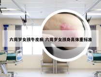 六周岁女孩牛皮癣 六周岁女孩身高体重标准