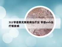 311窄谱黑光银屑病治疗仪 窄谱uvb治疗银屑病